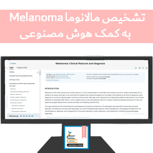 تشخیص مالانوما به کمک هوش مصنوعی